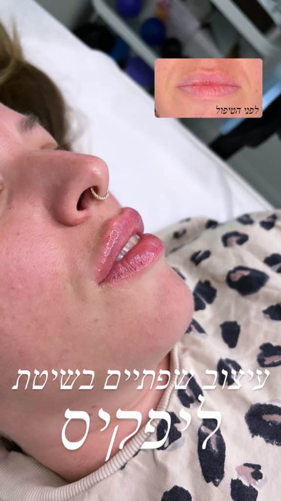 ליפקיס שפתיים 