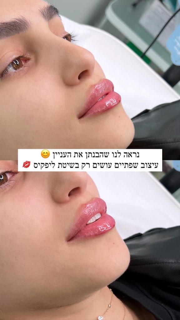ליפקיס 
